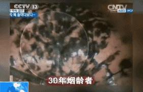 国外烟盒警示图片,看了这些你还想吸烟吗?