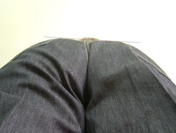 屁股歪了是怎么回事,屁股歪了骨盆怎么矫正