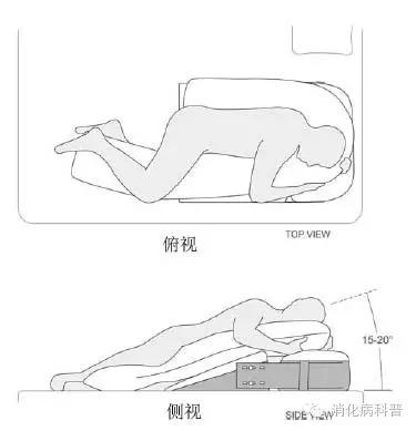 反酸烧心最快解决方法小妙招,对付反酸烧心有哪些小窍门