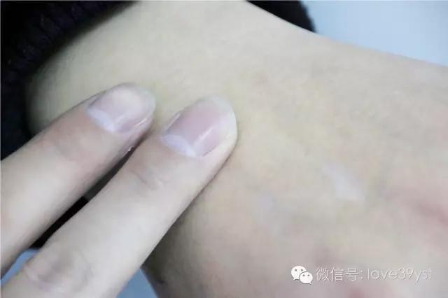 手上的青筋肿了怎么办,手血管突出青筋暴起是什么原因