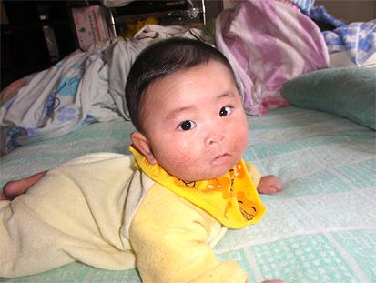 宝宝湿疹的定义,宝宝湿疹上海医院