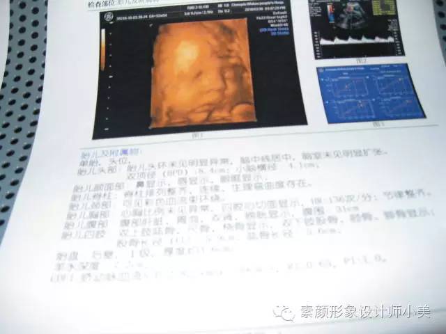 孕育课堂：怀孕三十二周胎儿发育与孕妈变化