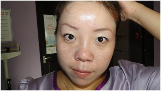 斑点的原因和改善方法,斑点问题怎么解决