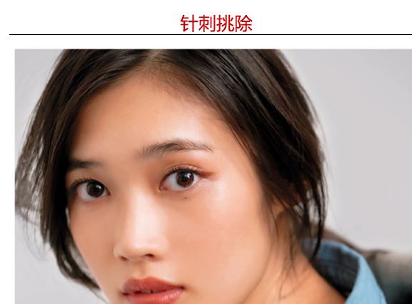 脂肪粒怎么去除最简单方法,为什么长脂肪粒怎么去除小窍门