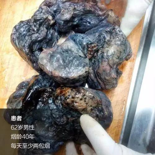 国外烟盒警示图片,看了这些你还想吸烟吗?