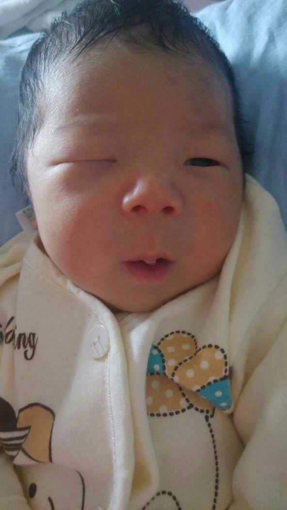 头胎剖腹二胎突然超快顺产,超快顺产5.2斤男宝一枚