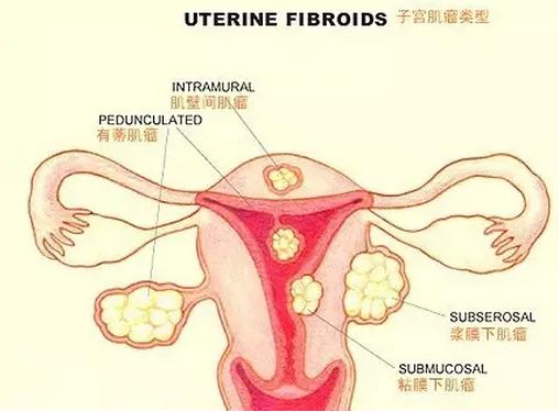 老年人卵巢有多大,中年女性卵巢少一个会有什么问题
