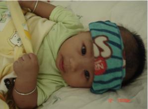 孩子发烧咳嗽,家长不要急着跑医院,试试这些偏方