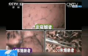 国外烟盒警示图片,看了这些你还想吸烟吗?