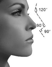 耳软骨隆鼻为什么鼻头还是很大,耳软骨隆鼻需要假体吗