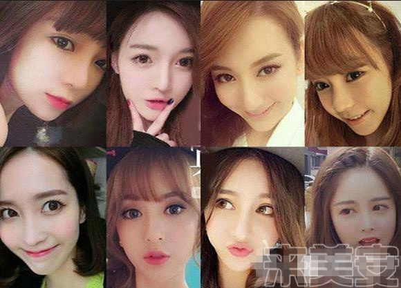 割双眼皮后悔的多还是不后悔的多,割双眼皮为什么前30天就那么难看