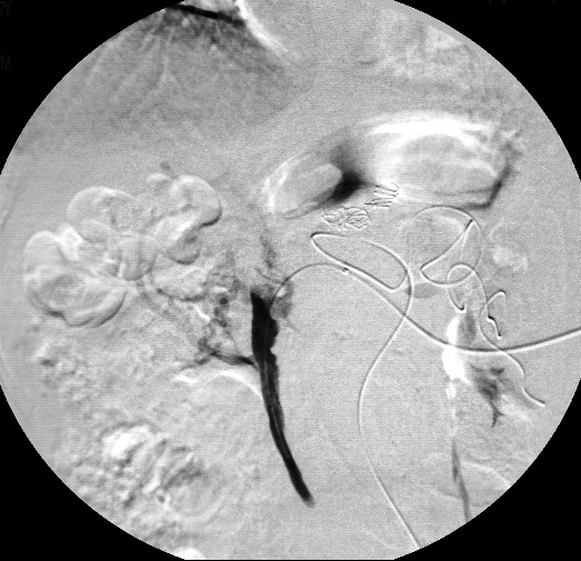 健康评估心脏检查操作,健康评估心电图检查重点知识