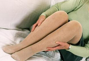 下肢静脉曲张如何预防和治疗,静脉曲张的原因及治疗或缓解方法