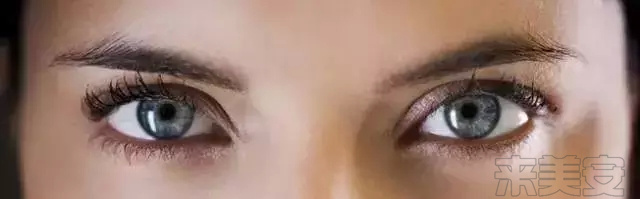 割双眼皮后悔的多还是不后悔的多,割双眼皮为什么前30天就那么难看