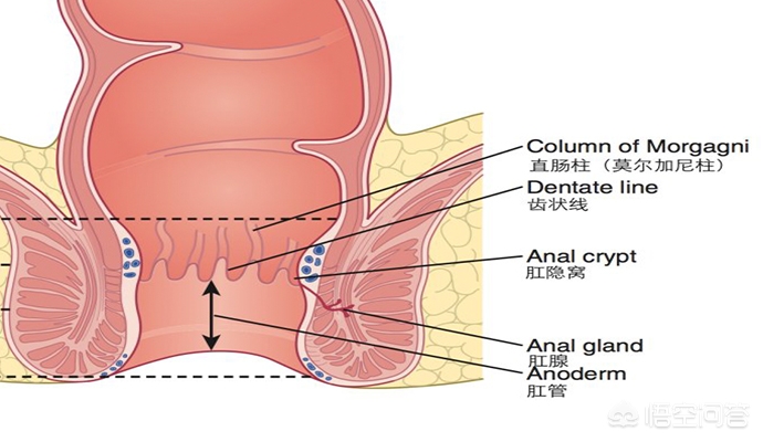 直肠癌与肛管癌，典型的同床异梦，表现和治疗根本不是一个套路！