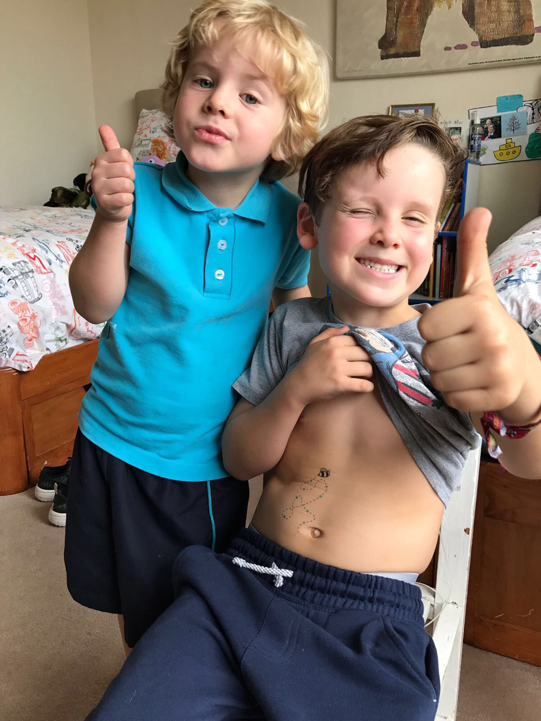 有变色的笔和纹身贴，你一定不知道这是为糖尿病儿童设计的胰岛素工具盒