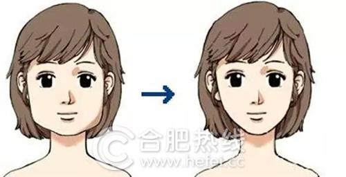 韩美医生,瘦脸针韩医生