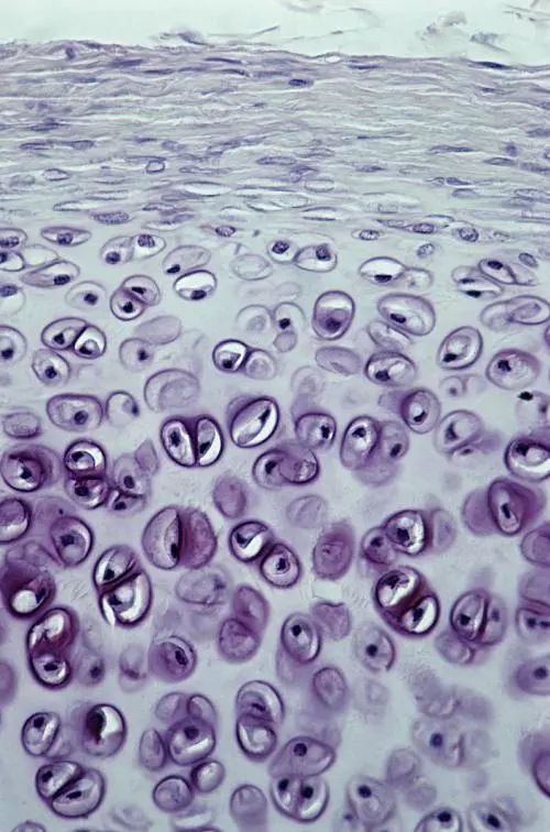 已经磨损的关节软骨可以再生吗,膝盖软骨磨损了还能再生吗