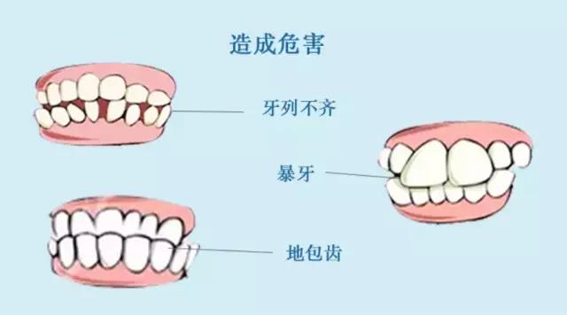 宝宝喜欢吮指怎么办,小朋友吮指如何戒掉