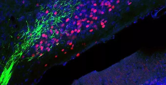 《细胞》:饥饿竟然能镇痛!科学家揭示相关神经通路,为非成瘾性镇痛药物开发带来新靶点|科学大发现