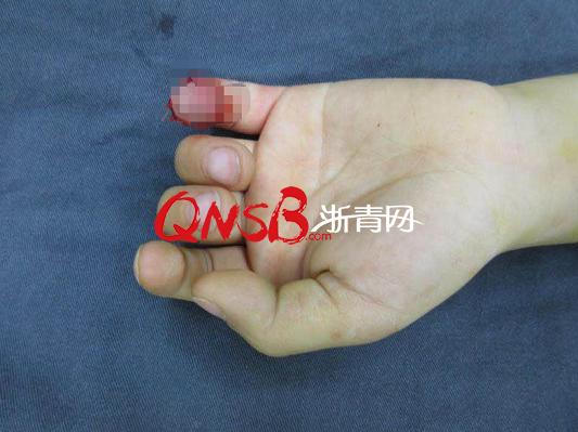 灏忓鎶婅烦缁冲す鍦ㄧ數姊噷鎵嬭鎷夋柇,7宀佺敺瀛╃帺鑰嶆妸鎵嬮敮鏂簡