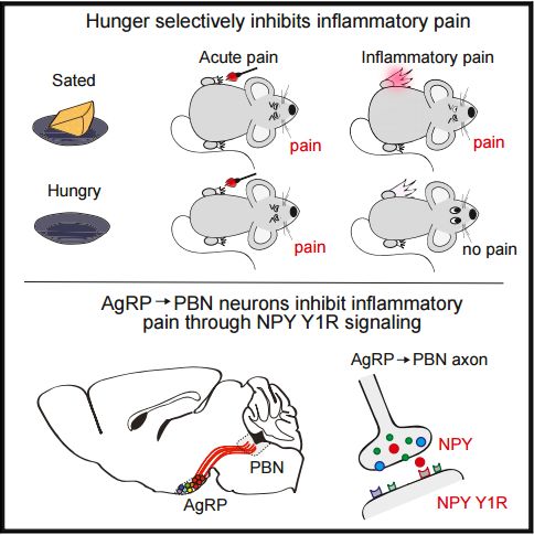 《细胞》:饥饿竟然能镇痛!科学家揭示相关神经通路,为非成瘾性镇痛药物开发带来新靶点|科学大发现