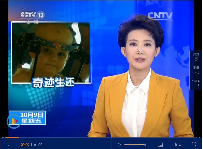 颈椎骨折急救颈托的正确戴法,颈椎损伤最快自愈办法