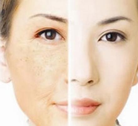 老祖宗传下来的民间秘方祛斑,老中医祖传美白祛斑百年秘方