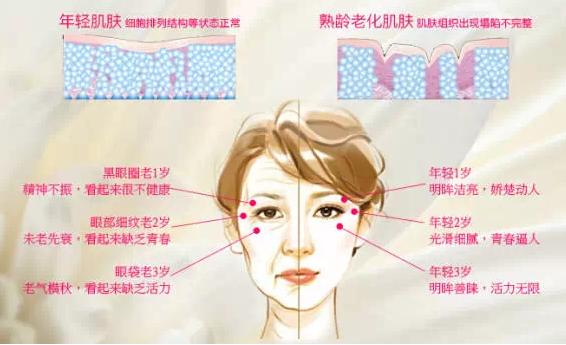 如何去除眼袋皱纹?养成好眼部的护理习惯