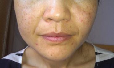 老祖宗传下来的民间秘方祛斑,老中医祖传美白祛斑百年秘方