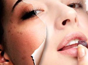 药吃多了会长色斑吗,反复刺激色斑