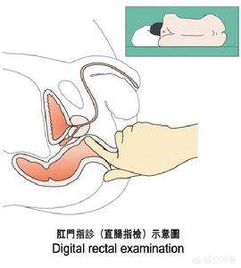 右肾15mm结节如何区分良性与恶性,4mm的实性结节怎样鉴别良性或恶性