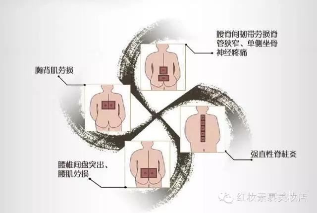 sinilpharm暖贴,韩国sinil疲劳贴