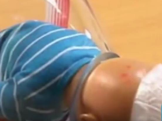 谁会想到,分娩辅助器点子,来自空瓶取软木塞