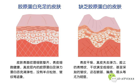 你只知道胶原蛋白能美容养颜?那可不行!