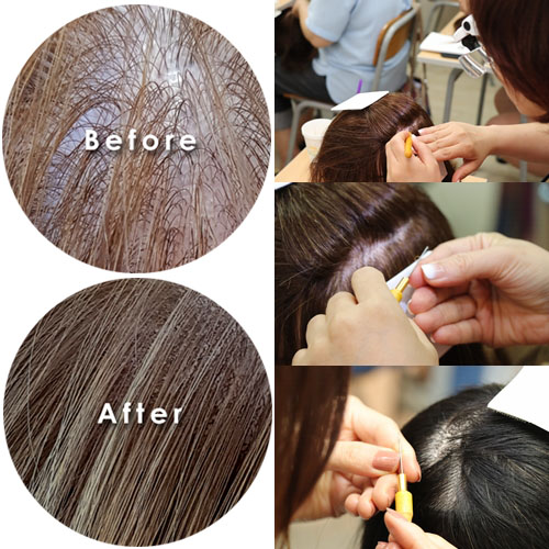 头发长短跟脱发有很大的关系吗,脱发如何改善和恢复发型