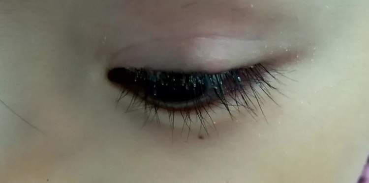 小孩眼红流泪有眼屎用什么滴眼液,孩子眼红有眼屎眼睛痒怎么办