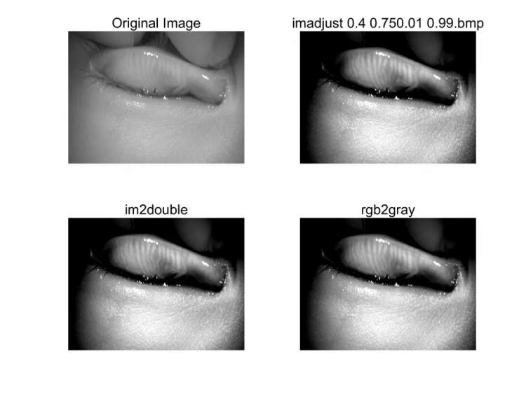 小孩眼红流泪有眼屎用什么滴眼液,孩子眼红有眼屎眼睛痒怎么办