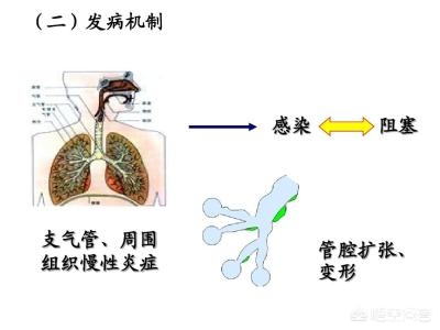 什么是支气管囊状扩张,支气管扩张肺部纹理变粗