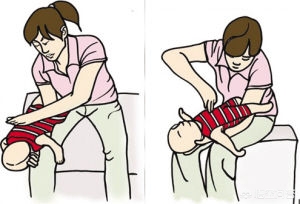 吸入异物立刻急救法,异物吸入急救方法视频