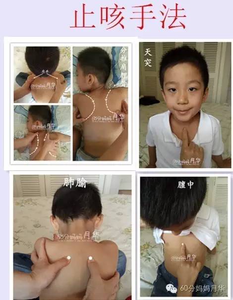 17种常见病小儿推拿组合手法,妈妈不要错过学习
