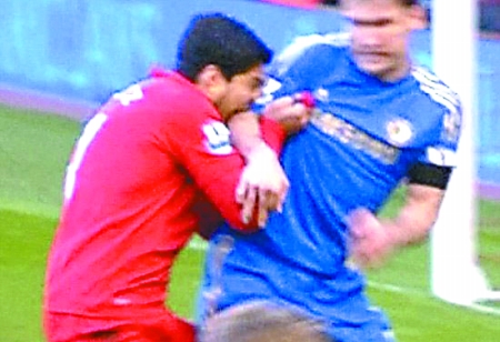 世上最大的足球惨案,世界足球最恐怖的受伤视频