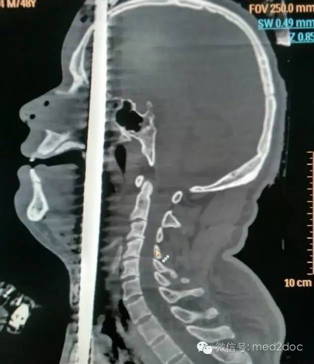 都伤成这样了还奇迹生还！向医生致敬！