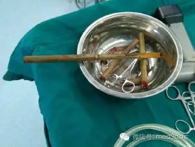 都伤成这样了还奇迹生还！向医生致敬！