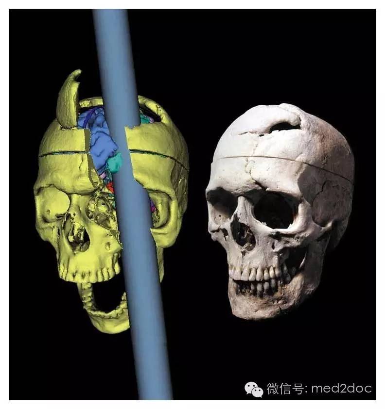 都伤成这样了还奇迹生还！向医生致敬！