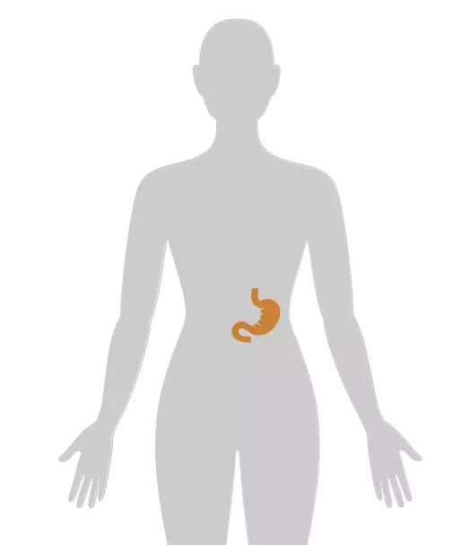 20张癌症人体地图告诉你致癌真相,2020癌症数据报告