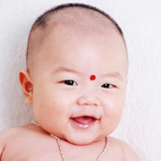 痱子湿疹的症状有哪些,痱子湿疹的治疗方法