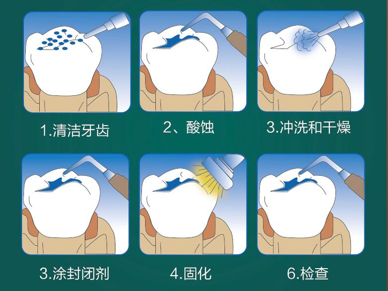老年人蛀牙很厉害建议拔牙吗,蛀牙快到牙根了需要根管治疗吗