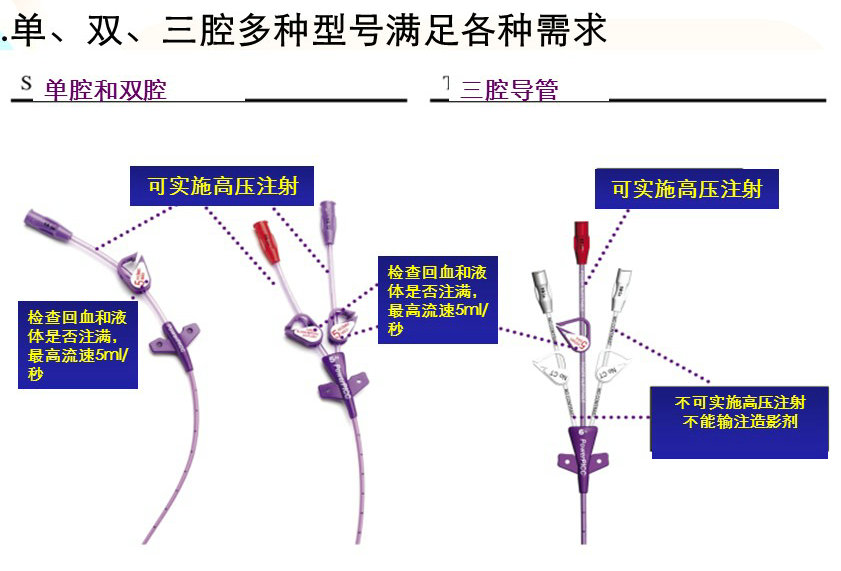 超声引导下改良塞丁格技术解剖图,超声引导下pdca置管