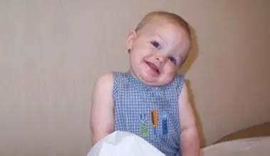 宝宝斜颈过度干预歪得更厉害,痉挛性斜颈的严重危害千万别忽视